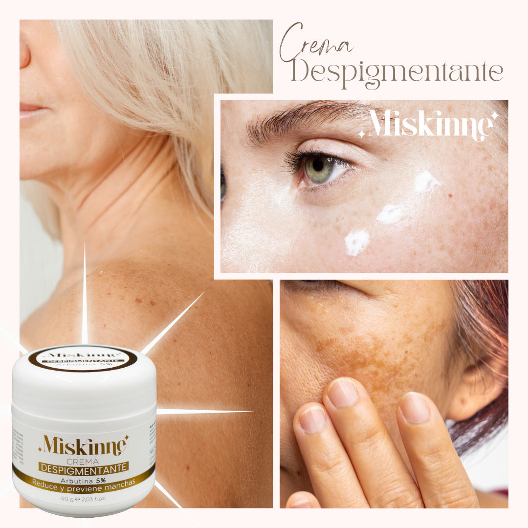 Miskinne crema despigmentante